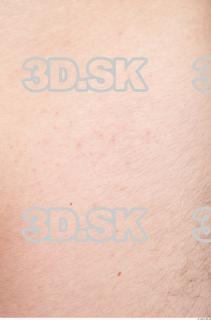 Skin texture of Dionyz 0002